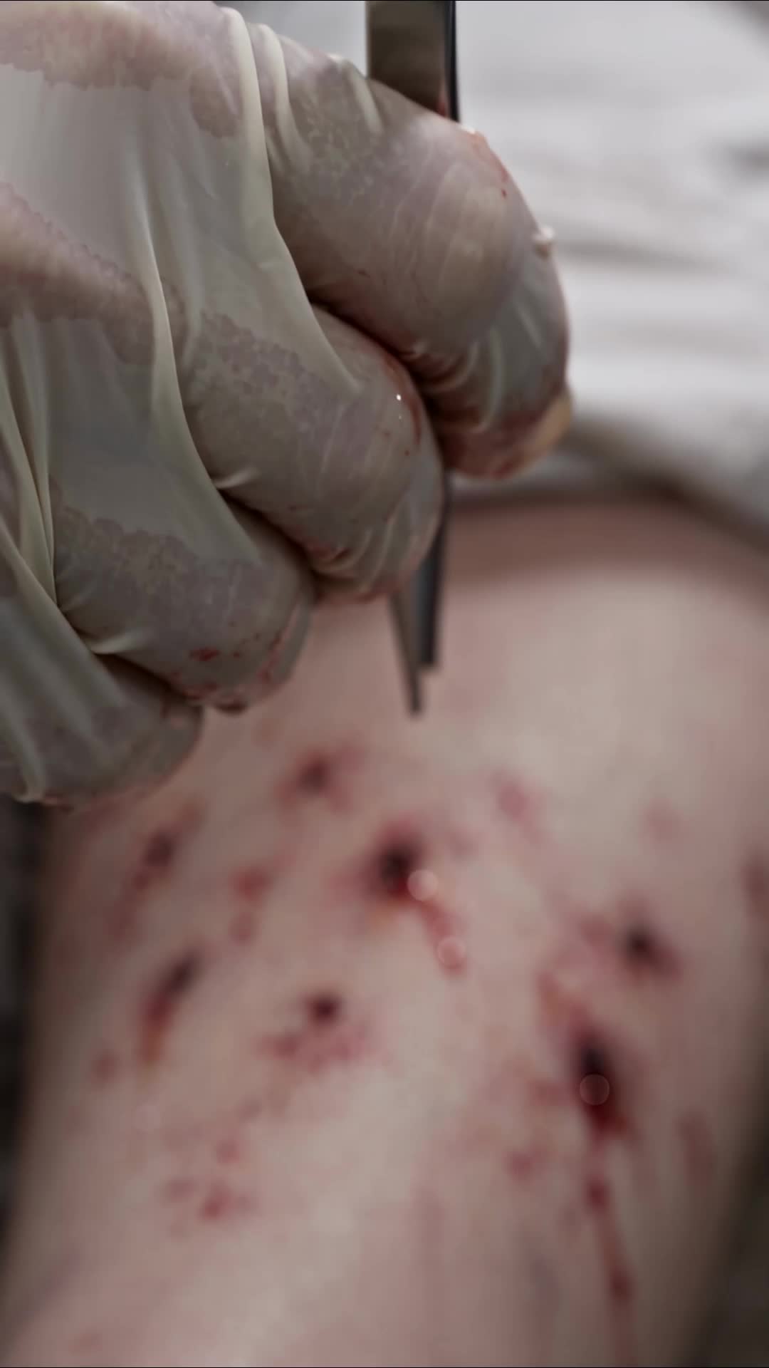 Episode 18