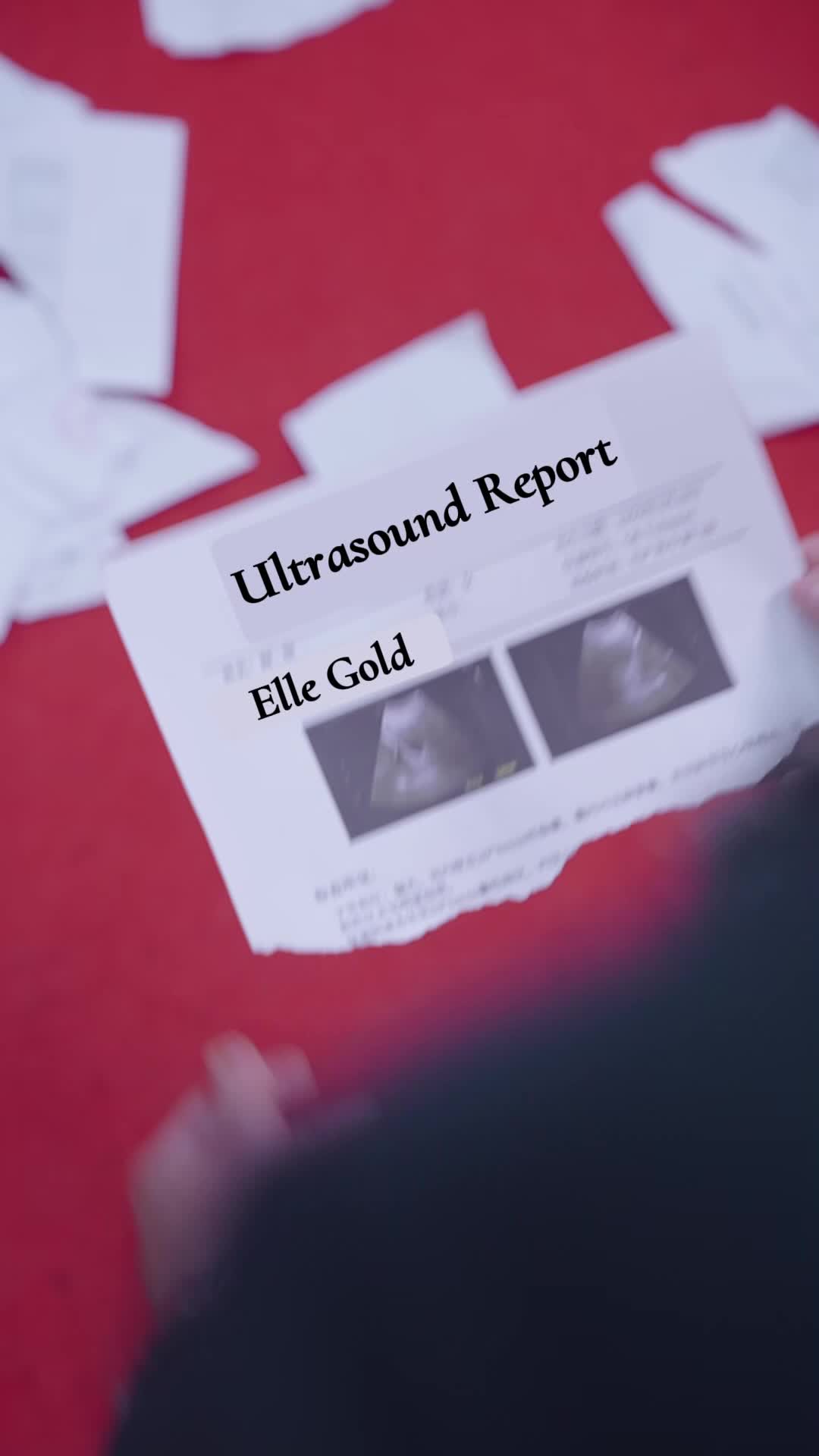 Episode 28